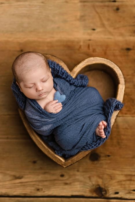 Baby Adrian after heart surgery